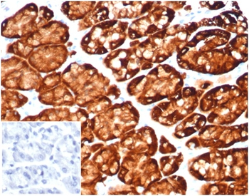 GLUL Antibody
