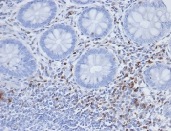 S100A4 Antibody