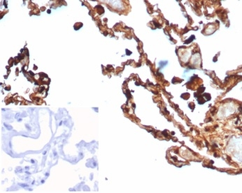 S100A4 Antibody
