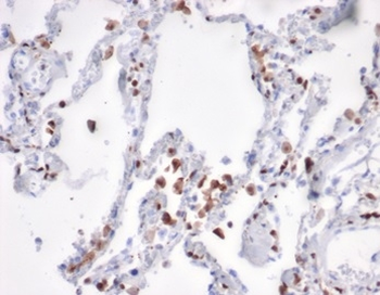 S100A4 Antibody
