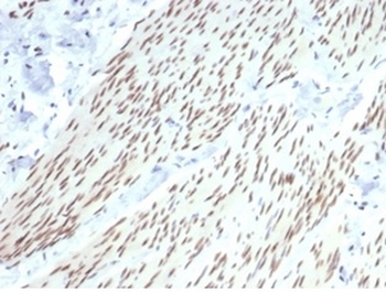 PGR Antibody