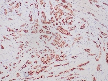 PGR Antibody
