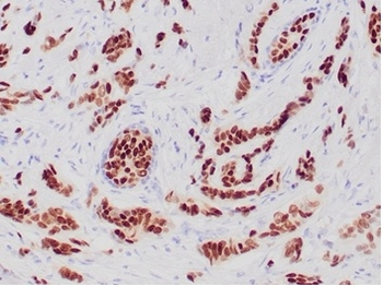 PGR Antibody