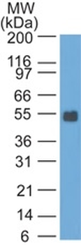 EPCAM Antibody