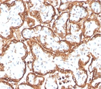 CGB3, CGB5, CGB8, NA Antibody