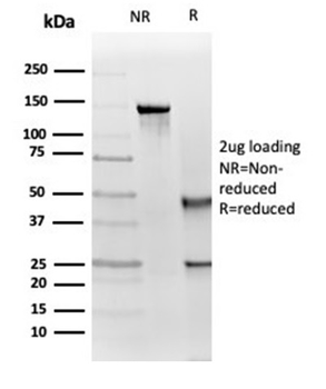 IGF1R Antibody