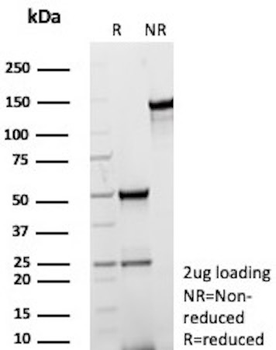 MERTK Antibody