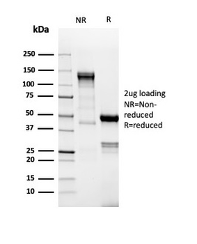 DNTT Antibody