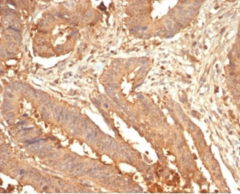 LGALS3 Antibody