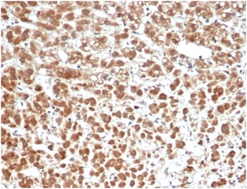 IL1B Antibody