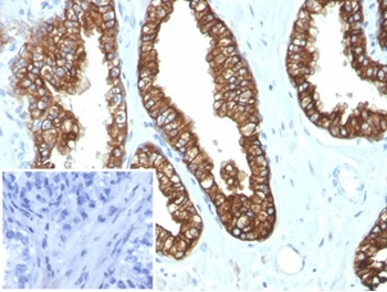 KRT8 Antibody