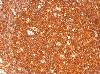 HLA-DRA Antibody