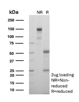 ABO Antibody