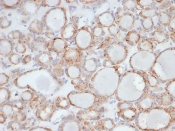 UBR2 Antibody
