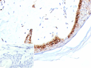 KLK4 Antibody
