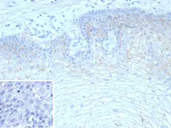 TRIM29 Antibody