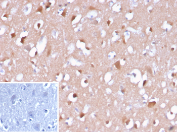 APP Antibody
