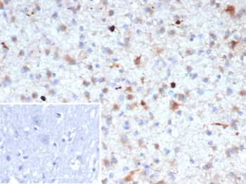 APP Antibody