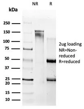 APP Antibody