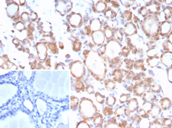 NTRK2 Antibody