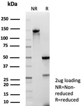 NTRK2 Antibody
