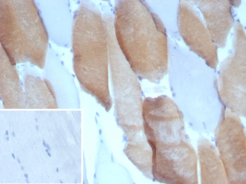 MYH7 Antibody