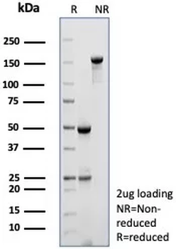 MYH7 Antibody