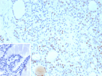 NKX2-1 Antibody