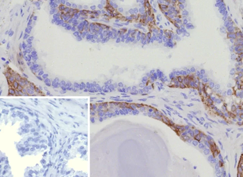 KRT15 Antibody