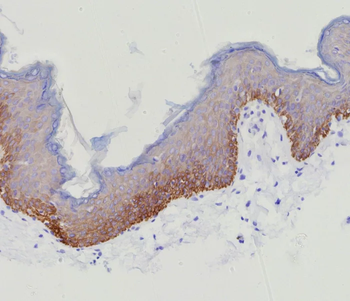 KRT15 Antibody