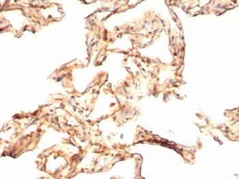 IL-6 Antibody