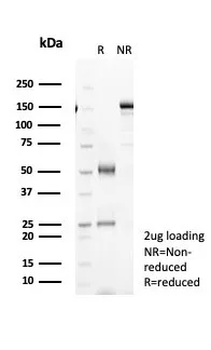 IL-6 Antibody