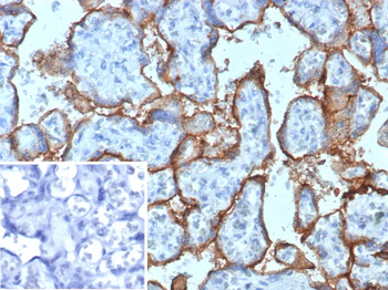 HMMR Antibody