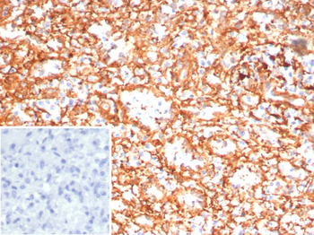 ADCY8 Antibody