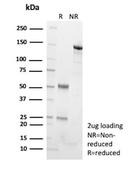 ADCY8 Antibody