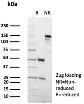 ADCY8 Antibody