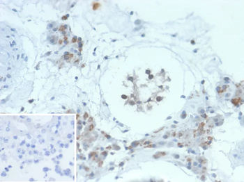GCSAM Antibody