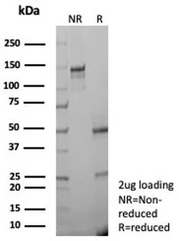KRT76 Antibody