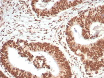 WTAP Antibody