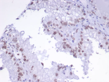 TFAP2A Antibody