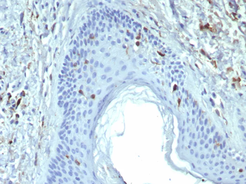 CD207 Antibody