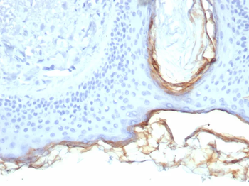 KLK5 Antibody