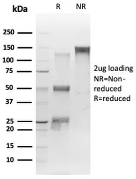 TARDBP Antibody