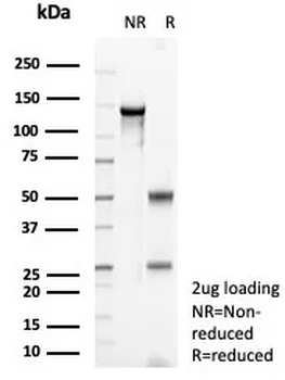SATB2 Antibody