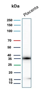 EBI3 Antibody