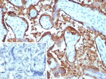 EBI3 Antibody