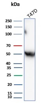 SERPINA1 Antibody