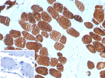 MYH7 Antibody