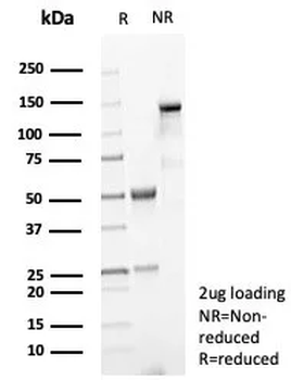 MYH7 Antibody