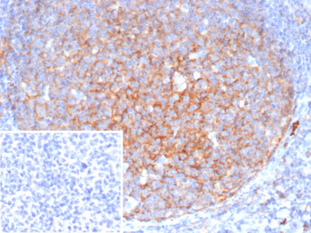 ITGAM Antibody